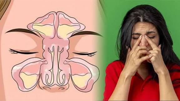 बंद नाक से हैं परेशान? अपनाएं ये 4 आसान घरेलू उपाय, मिल सकती है राहत