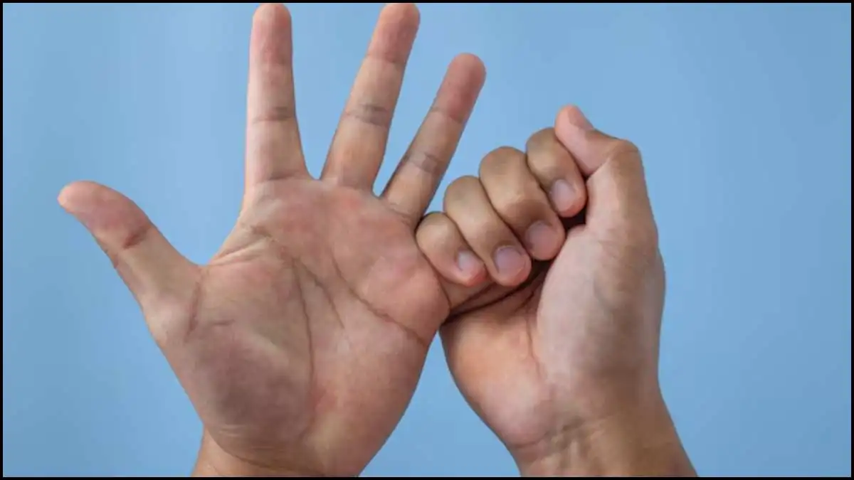 Pinky Finger Syndrome क्या है? लगातार मोबाइल चलाने वालों के लिए जरूरी चेतावनी