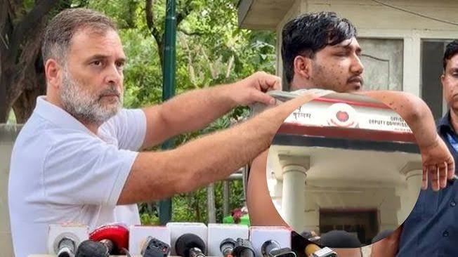 संसद मार्ग थाने पहुंचे राहुल गांधी, पैलेट गन से घायल शख्स को लेकर उठाए सवाल
